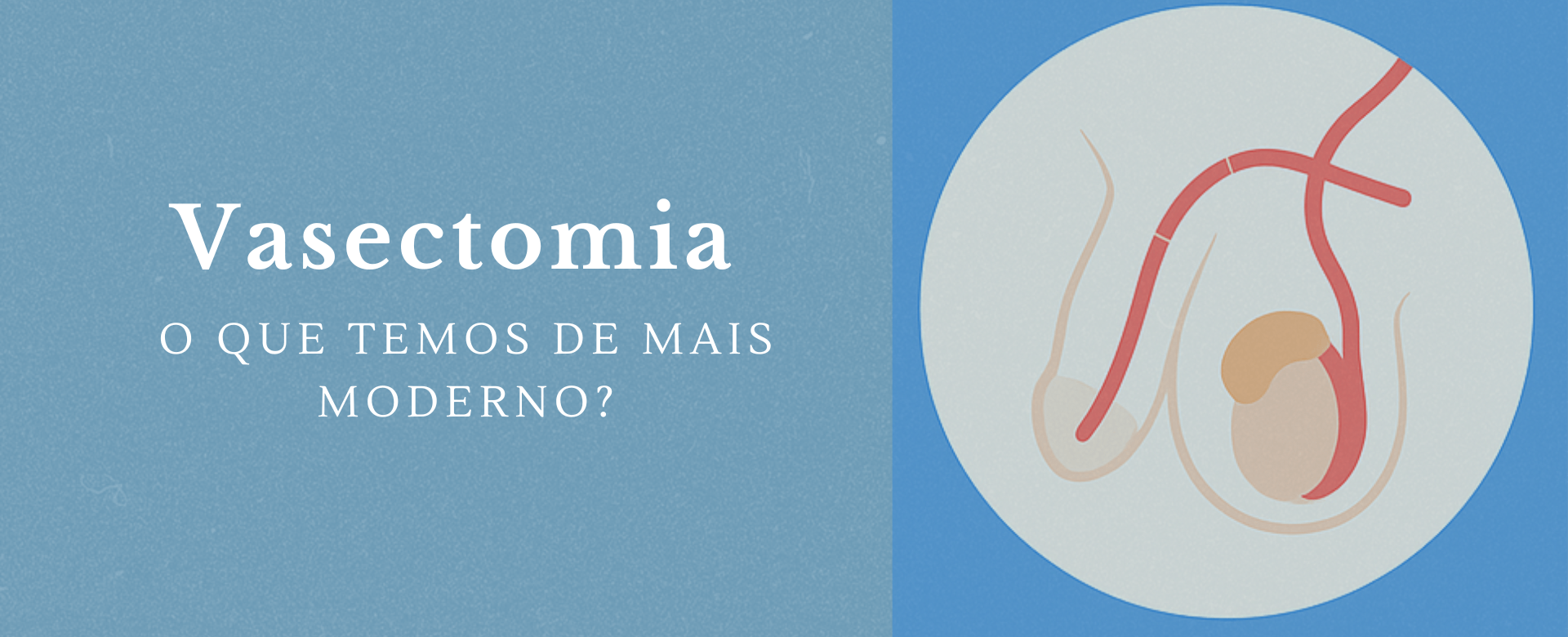 Infográfico em português sobre vasectomia moderna com fundo azul, explicando o que é, como é feita, tempo de recuperação e principais efeitos, com ícones médicos simples e texto claro.