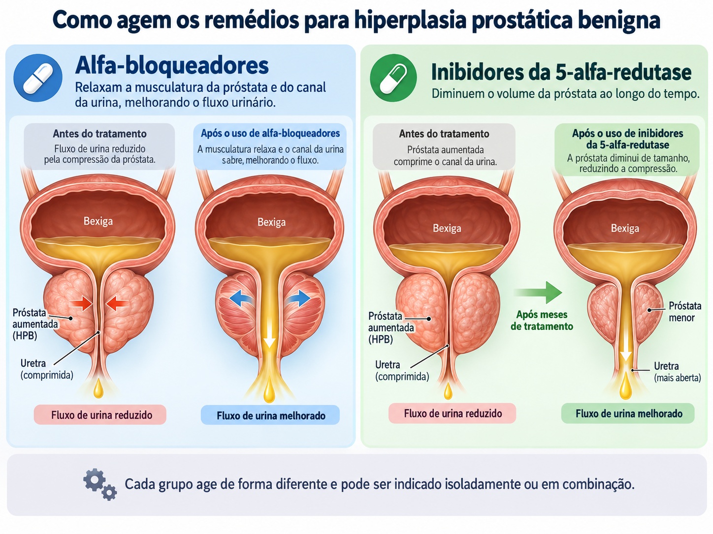 Ilustração de como age o remédio para hiperplasia prostática benigna: um grupo relaxa o canal da urina e o outro diminui a próstata